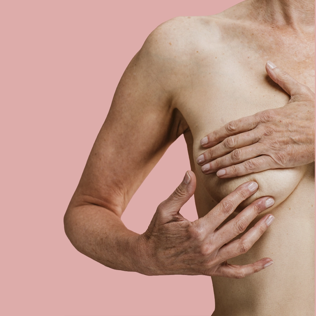 Breast Uplift